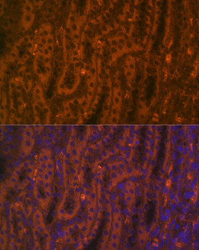 ACE2 antibody