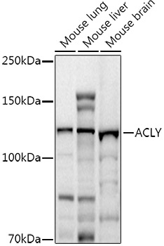 ACLY antibody