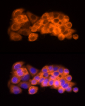 ACLY antibody