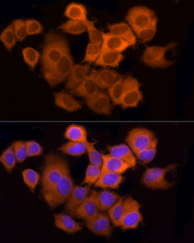 ACLY antibody