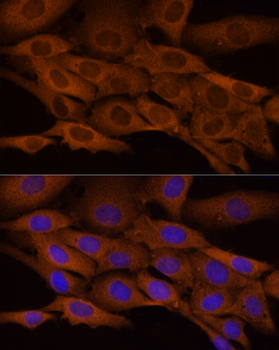 ACLY antibody