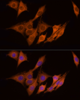 ACLY antibody