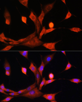 ADK antibody