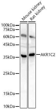 AKR1C2 antibody