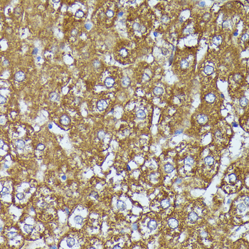 AKR1C2 antibody