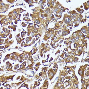 AKR1C2 antibody