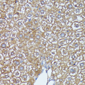 AKR1C2 antibody