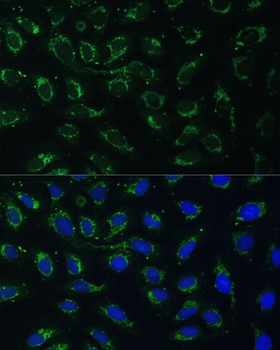 AKR1C2 antibody