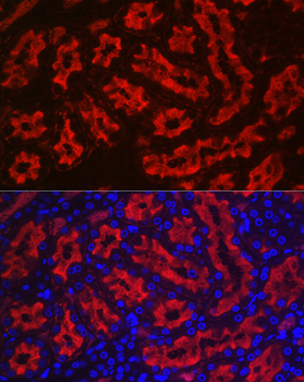 Aquaporin antibody