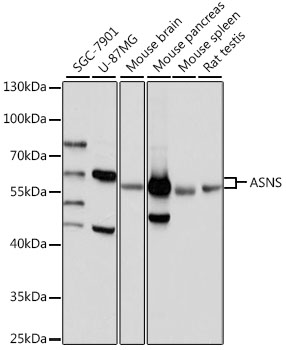 ASNS antibody