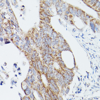 ATG16L1 antibody