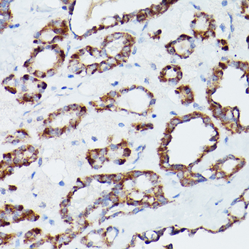 ATG16L1 antibody