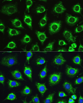 ATG16L1 antibody