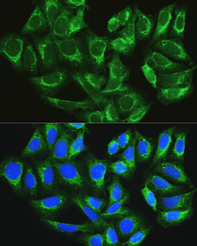 ATG16L1 antibody