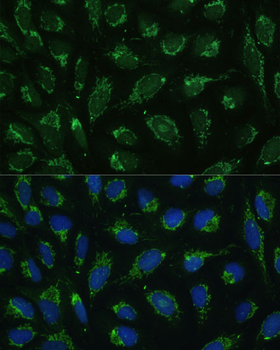 ATP5C1 antibody