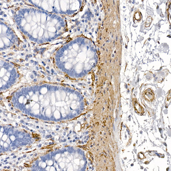 Caveolin 1 antibody