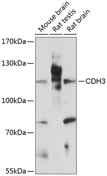 P-Cadherin antibody