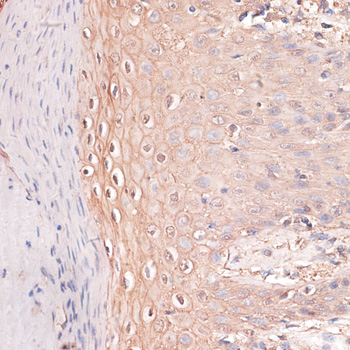 P-Cadherin antibody