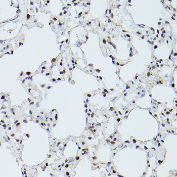 CDK9 antibody