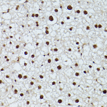 CDK9 antibody