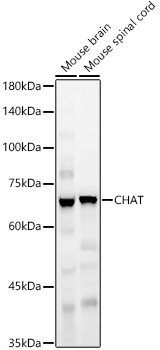 CHAT antibody