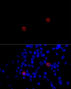 CLEC4M antibody