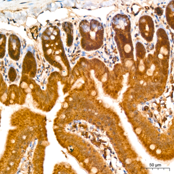 CNBP antibody