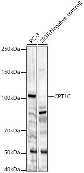 CPT1C antibody