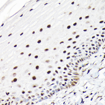 CTCF antibody