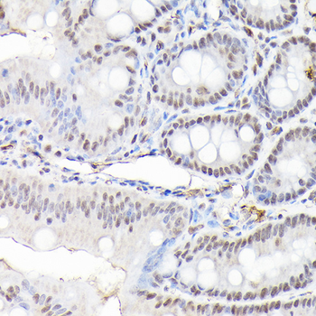 CTCF antibody