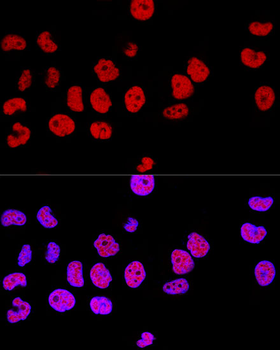 CTCF antibody