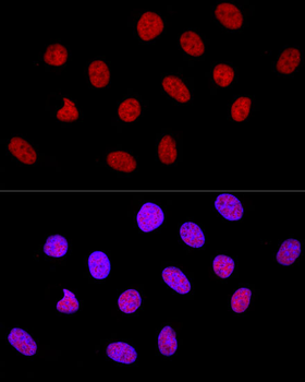 CTCF antibody