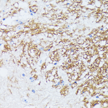 CTNNA2 antibody