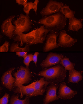 CTTN antibody