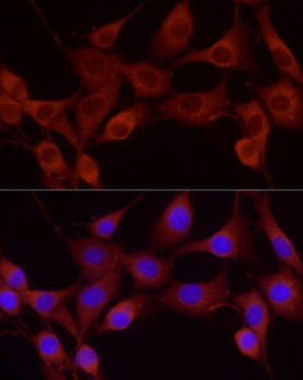 CTTN antibody