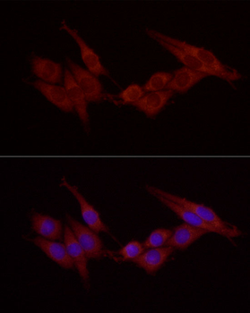 CTTN antibody