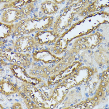 DAPK3 antibody