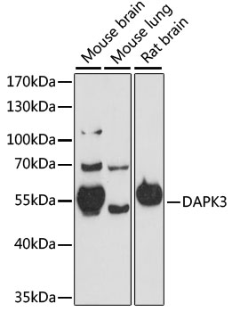 DAPK3 antibody