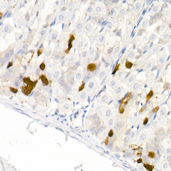 DDC antibody