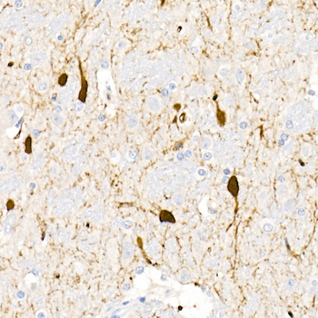 DDC antibody