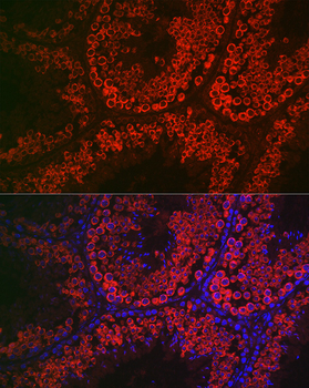 DDX4 antibody