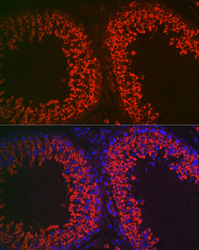 DDX4 antibody