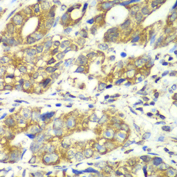 DLST antibody