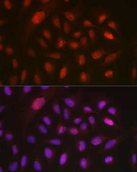 DYNLL1 antibody