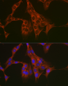 EEF1A1 antibody