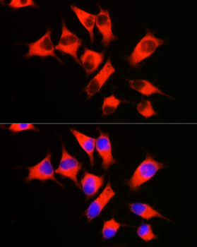 EEF1A1 antibody