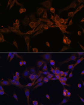 EIF2B2 antibody