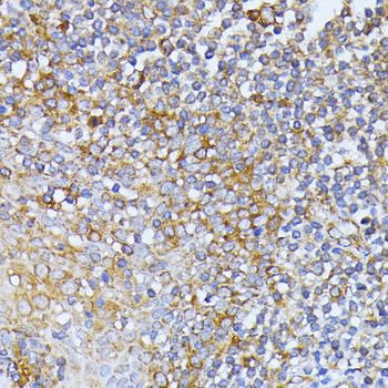 EIF2B2 antibody