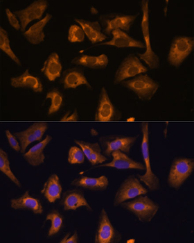 EIF5B antibody