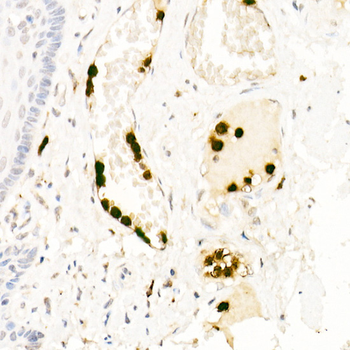 Neutrophil Elastase antibody